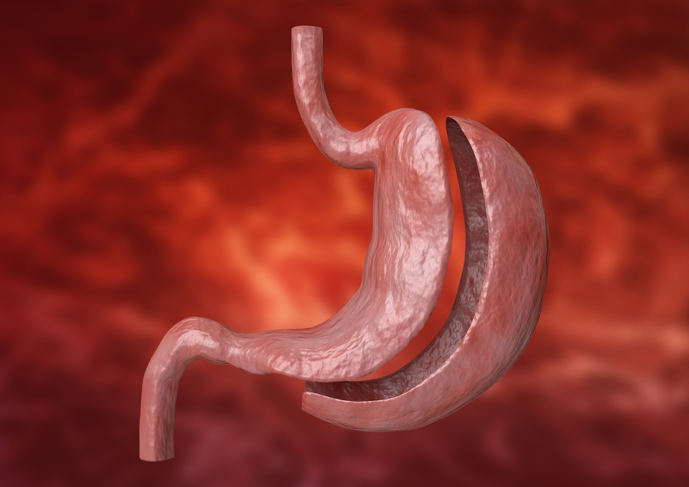Stomach & Esophagus Surgery